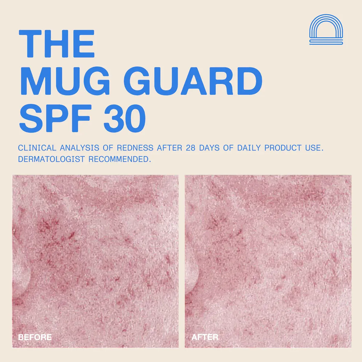 THE MUG GUARD Face Sunscreen :: 72 ML/2.4 FL OZ • FRAGRANCE FREE